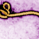 Illustration for article titled Ebola Survivors Are Being Urged To Abstain From Sex